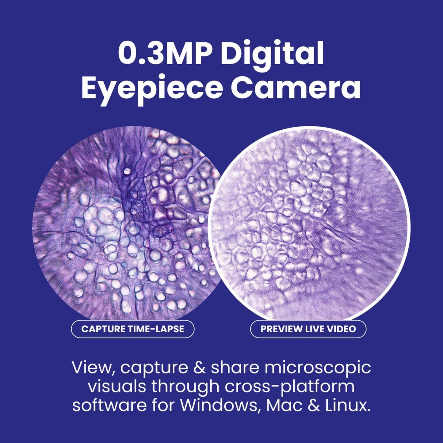 AmScope B120 Series Student & Professional LED Binocular Compound Microscope - 40X-2500X Magnification - Includes 0.3MP USB 2.0 Camera & Siedentopf Head