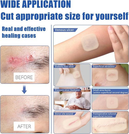 EASETEC 4"x4" Hydrocolloid Bandages 20 Packs, Thin Self-Adhesive Hydrocolloid Wound Dressing, Waterproof Patch for Bedsores, Ulcers & Surgical Incisions