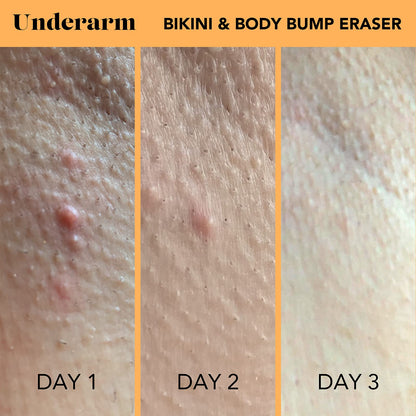 SweetSpot Labs Bikini & Body Bump Eraser, Razor Bump and Dark Spot Treatment with Niacinamide, 0.5 oz